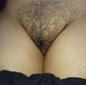hairy pussy nude pic